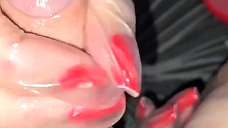 A Nurse Takes Semen for Analysis