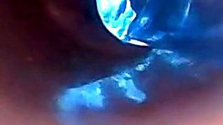 Endoscope POV: Test Tube Cock Urethral Insertion