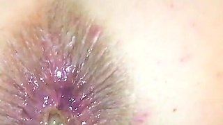 Farting Cum Out My Ass From Hot Anal Sex!