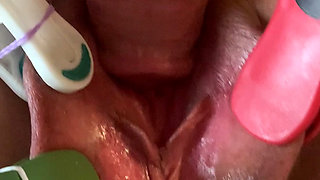 Lip Clip